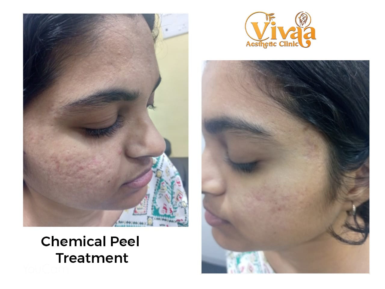 Best Dermatologist in Madurai